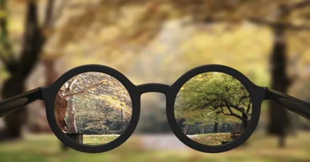 Sel Du Dr Toulemont CONGENITAL MICROCORIA MYOPIA AND GLAUCOMA A UNFORTUITOUS ASSOCIATION