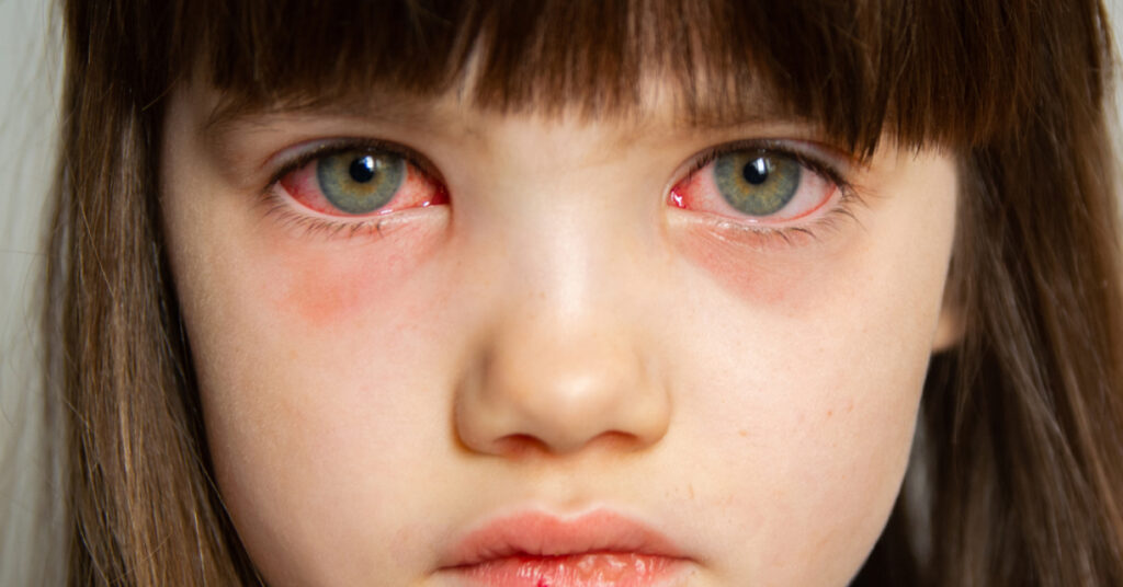 Sel Du Dr Toulemont LES ENFANTS VICTIMES DE SEVICES
