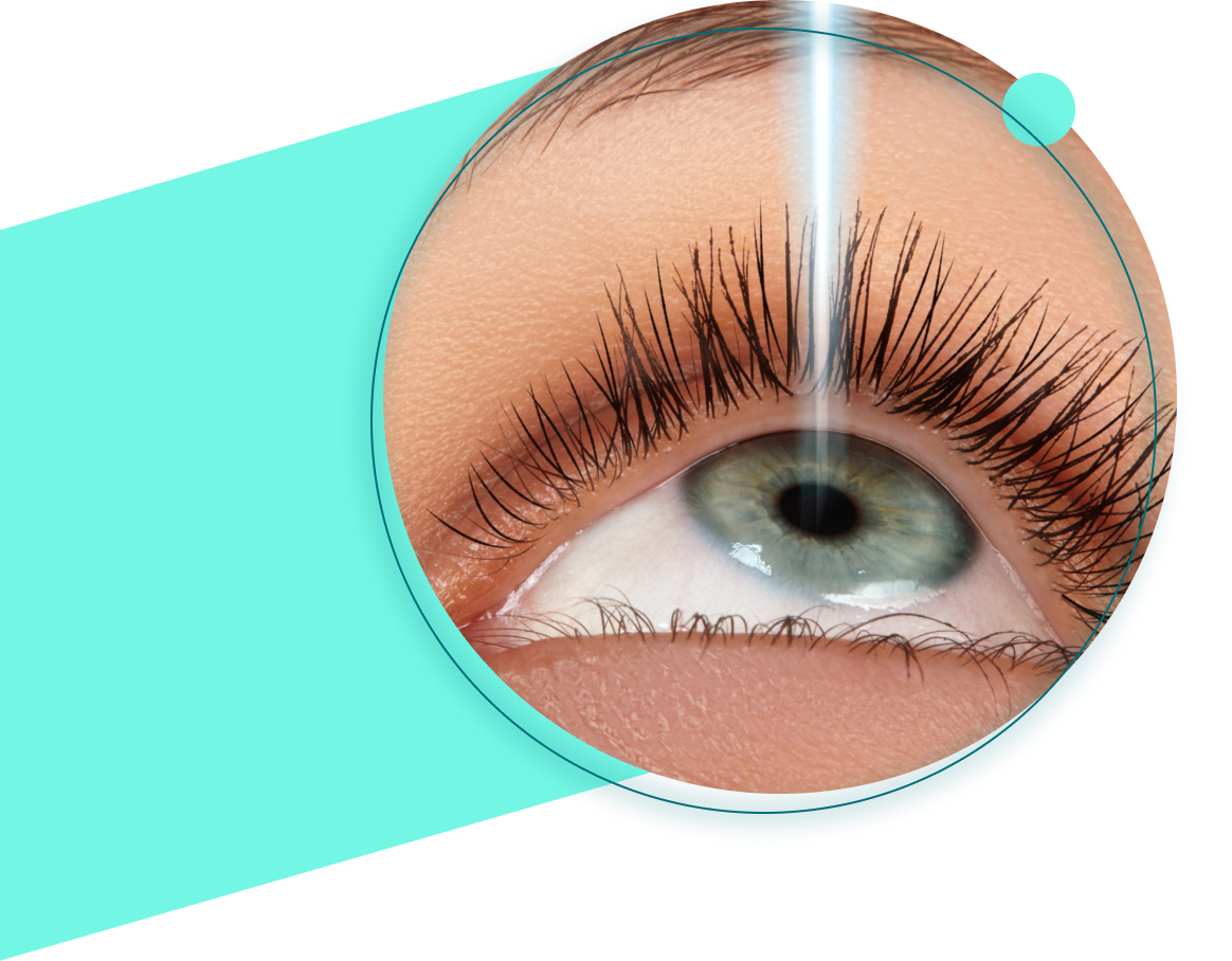 Sel Du Dr Toulemont Lasik