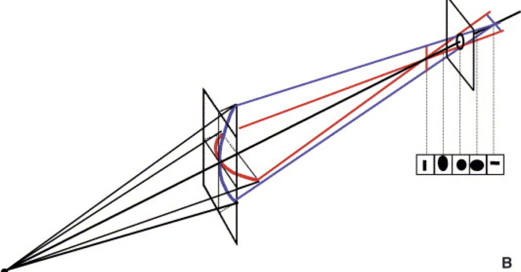 Sel Du Dr Toulemont MODELES VECTORIELS DANALYSES DES VARIATIONS DASTIGMATISME CORNEEN ANTERIEUR