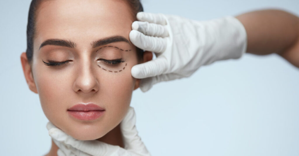 Sel Du Dr Toulemont QUANTIFICATION OF SURGICALLY INDUCED ASTIGMATISM A NEW STATISTICAL APPROACH