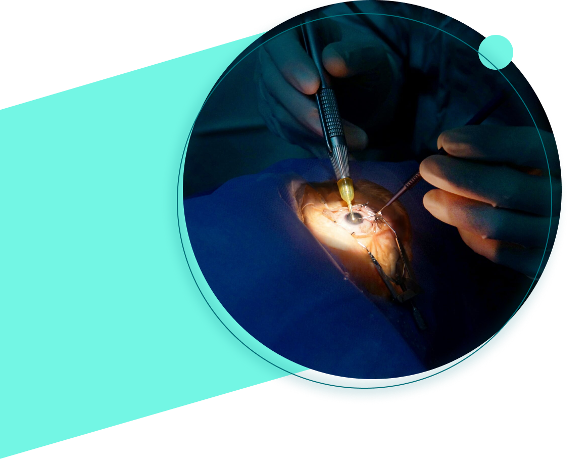 Sel Du Dr Toulemont VOLUTION DE LA CORRECTION OPTIQUE DES OPERES PARTIE 1
